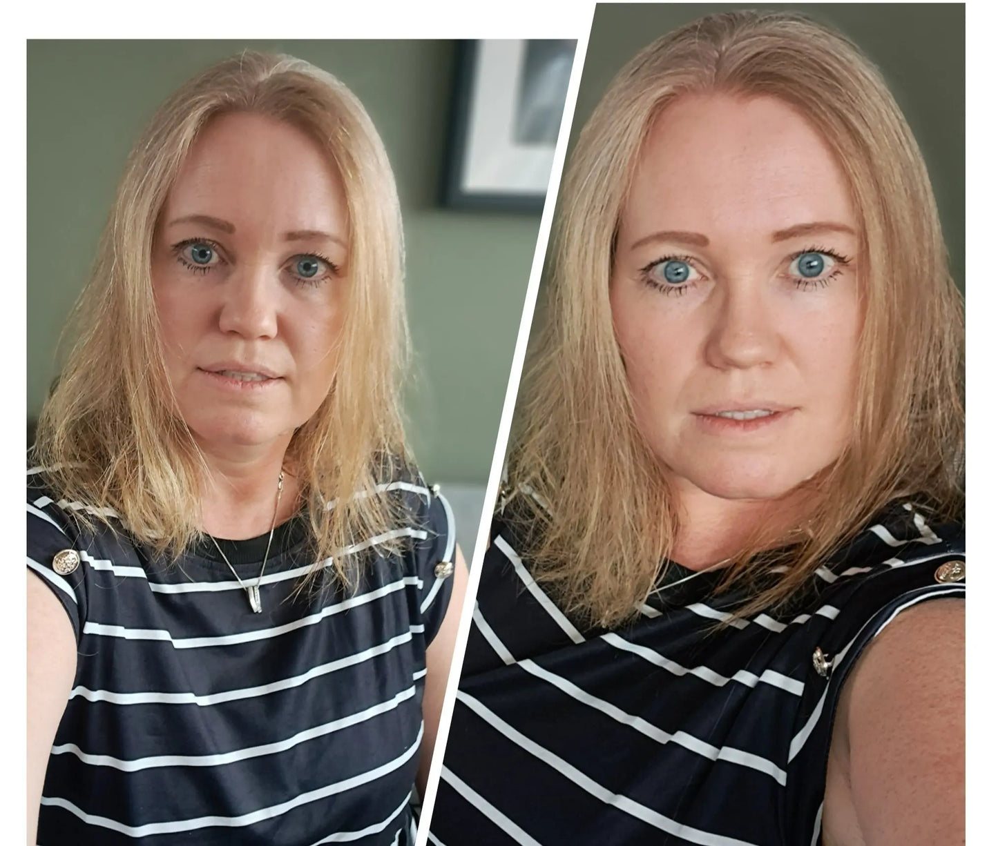 Stripete topp med knapper til damer Unike turprodukter